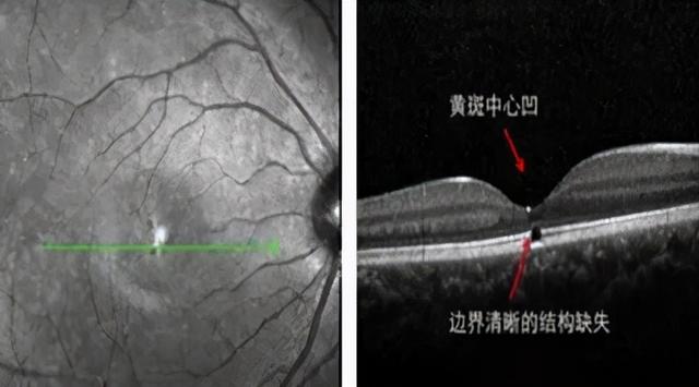 激光防護(hù)(激光個(gè)人防護(hù)措施) 第3張